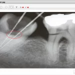 chARM-dentistry-EHR-Software-and-patient-portal