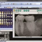 Dentrix-Ascend-EMR-and-Practice-Management-Software-Patient-e-Rx