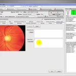 LiquidEHR-Optometery-EHR-software-PM-software-Patient-Scheduling