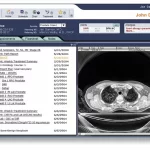 MOSAIQ-EMR-Practice-Management-Software-Diagnoses-and-Interventions