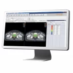 MOSAIQ-EMR-Software-Elekta-EHR-and-Practice-Management-Software