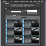 Nextech-EMR-Software-Dermatology-Patient-Detail