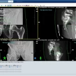 Varian-ARIA-Oncology-EMR-Software-and-patient-portal